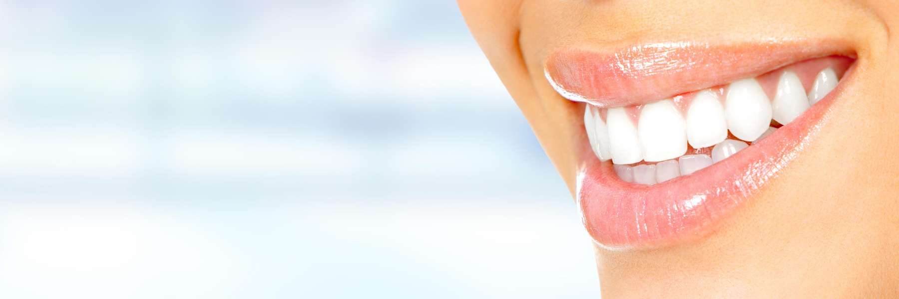 Close up of womans smile, brentwood tn