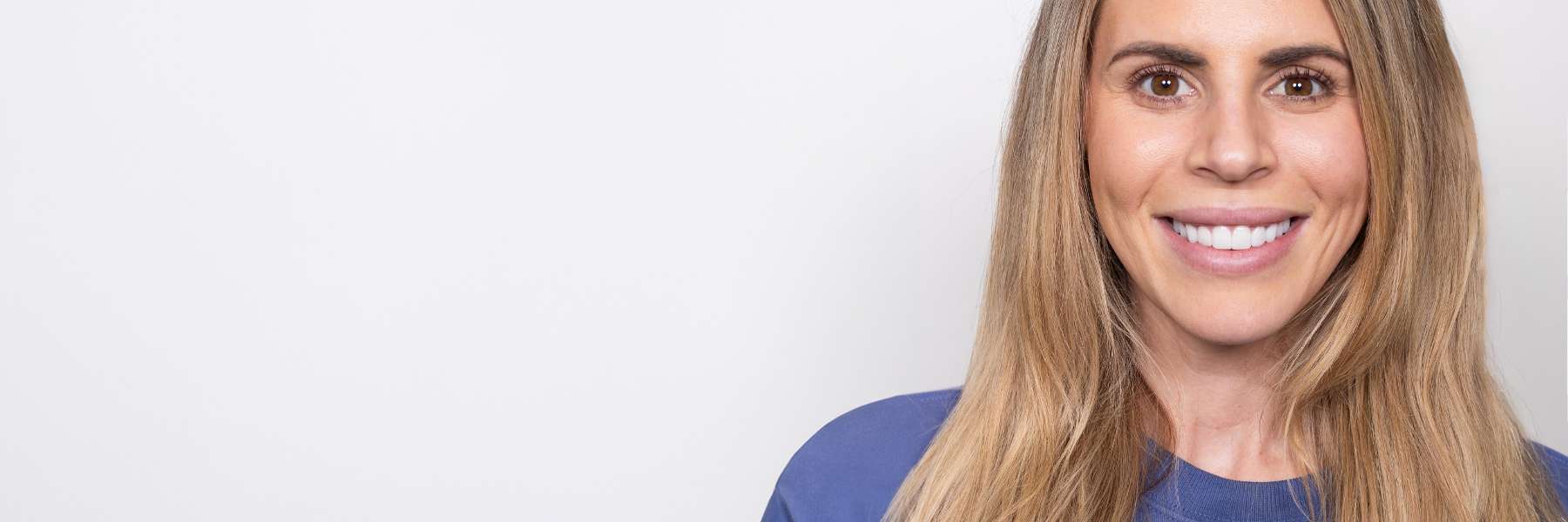 Porcelain Veneers | Dentist