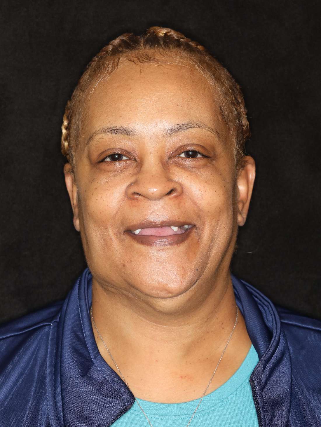 Woman smiling before all-on-x implant dentures, nashville tn