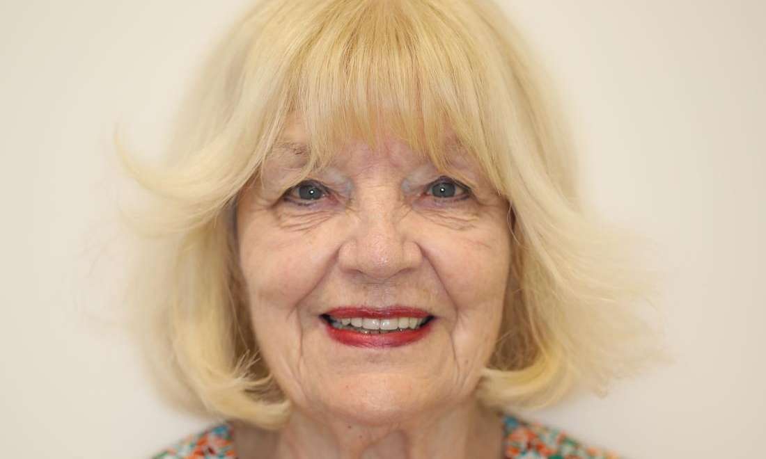 Full head view of elderly woman smiling before cosmetic crowns, brentwood tn