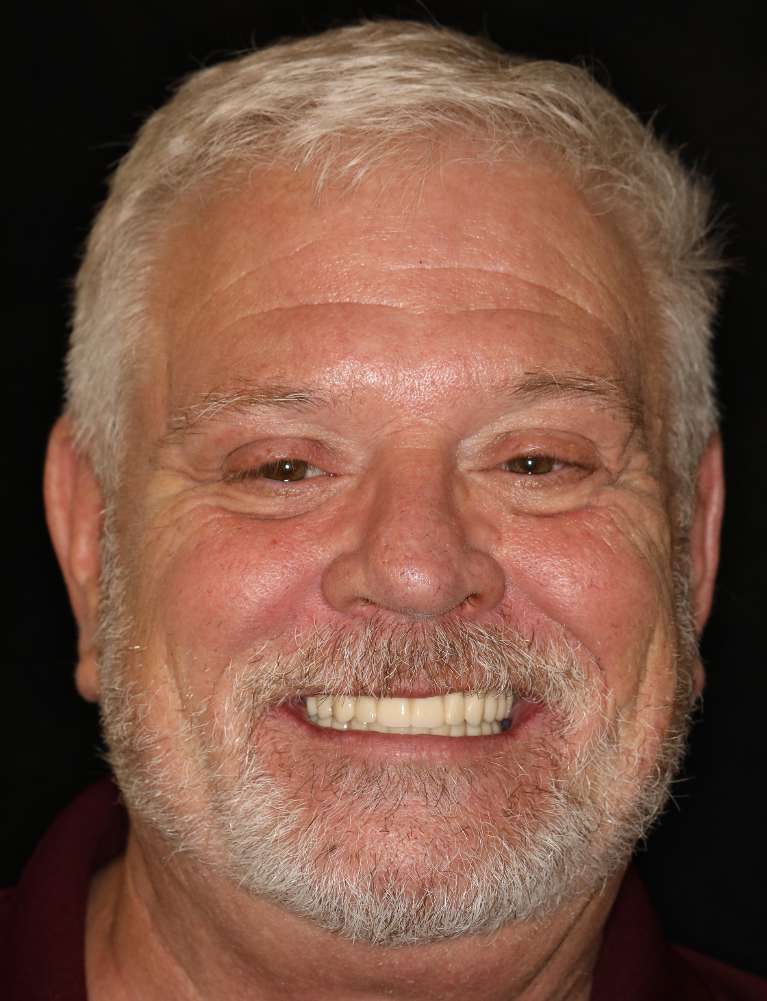 Older man smiling after all-on-x implant dentures, nashville tn