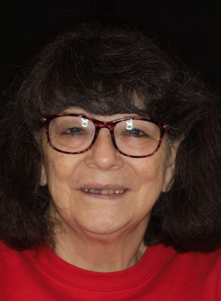 Before all-on-x implants, brentwood tn