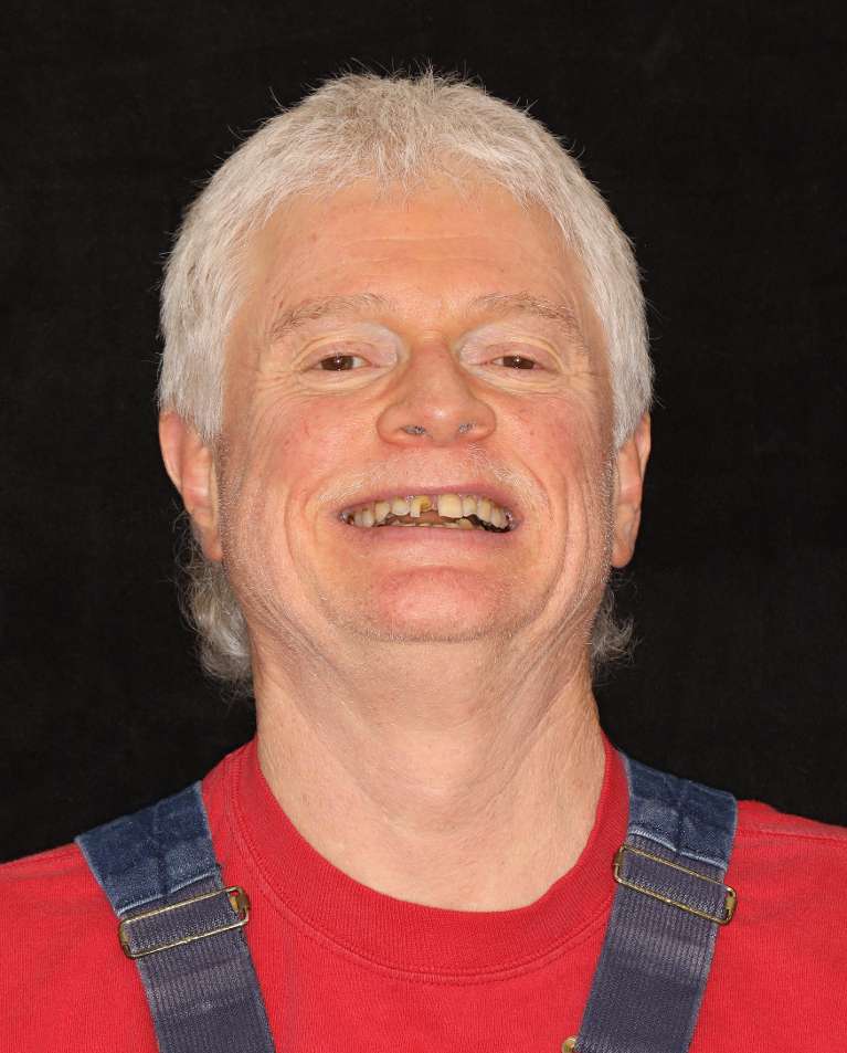 Older man smiling before a smile makeover, nashville tn