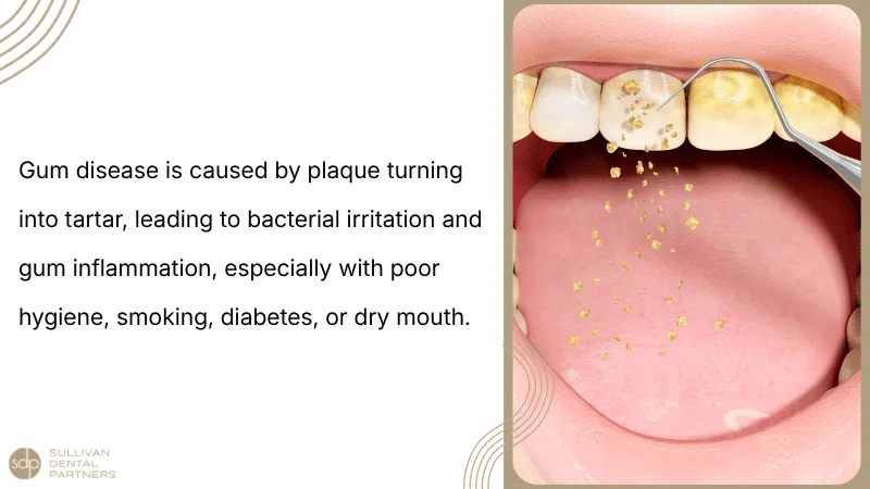 Causes Plaque, Tartar, And Bacterial Biofilm
