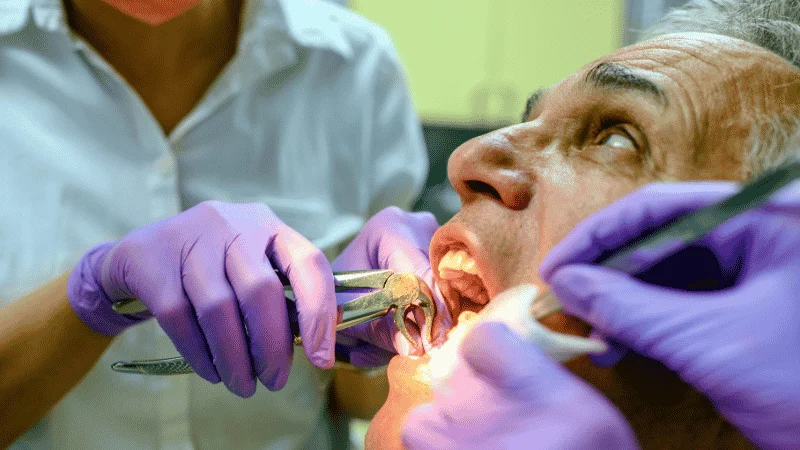 Common Types Wisdom Tooth Extraction, Dental Implants, And More