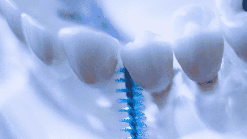 Daily Brushing, Flossing, And Interdental Brushes