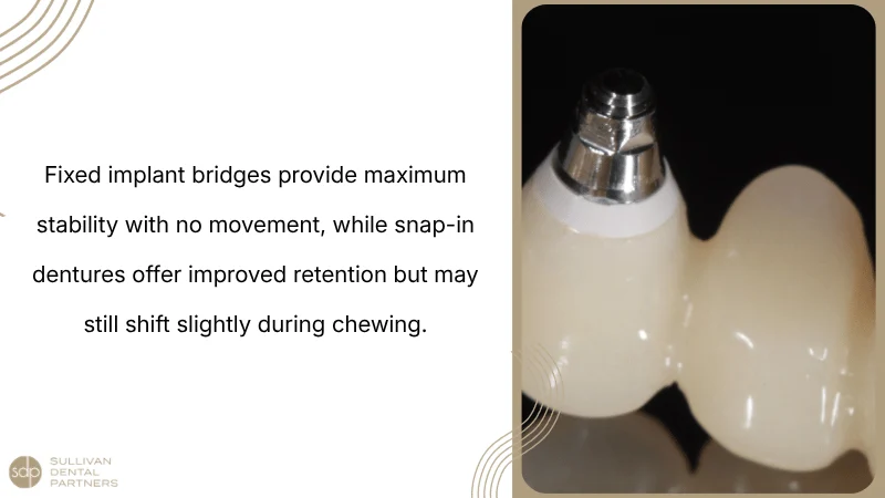 Denture Stability And Implant Retention