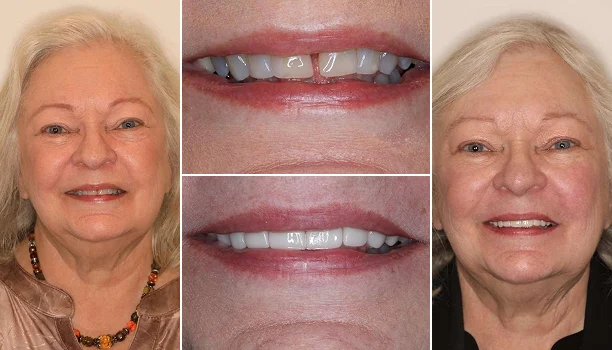 Home Page Smile Transformation Img 10