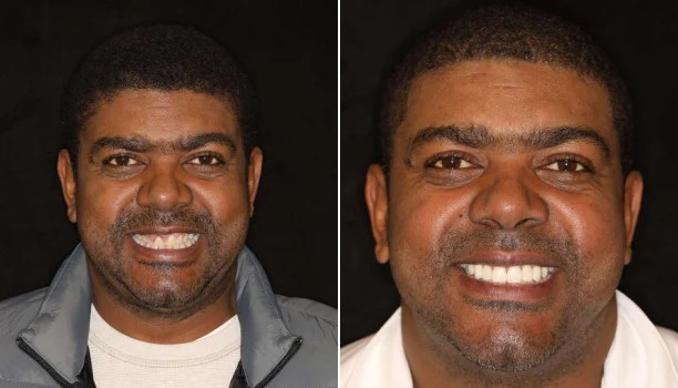 Home Page Smile Transformation Img 11
