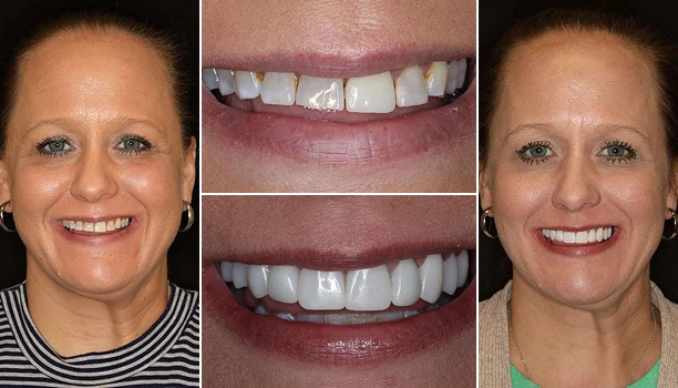 Home Page Smile Transformation Img 9